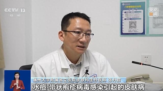 春季高发的带状疱疹：打破常见误解，解读带状疱疹：消除误解，科学应对